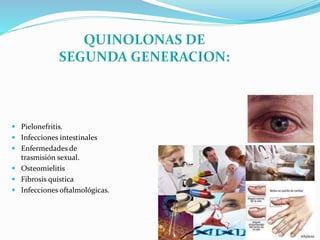  Pielonefritis.
 Infecciones intestinales
 Enfermedades de
trasmisión sexual.
 Osteomielitis
 Fibrosis quística
 Infecciones oftalmológicas.
 
