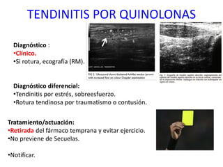 TENDINITIS POR QUINOLONAS
Tratamiento/actuación:
•Retirada del fármaco temprana y evitar ejercicio.
•No previene de Secuelas.
•Notificar.
Diagnóstico :
•Clínico.
•Si rotura, ecografía (RM).
Diagnóstico diferencial:
•Tendinitis por estrés, sobreesfuerzo.
•Rotura tendinosa por traumatismo o contusión.
 