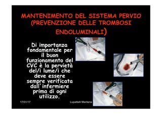 17/01/17 Lupattelli Marilena
MANTENIMENTO DEL SISTEMA PERVIO
(PREVENZIONE DELLE TROMBOSI
ENDOLUMINALI)
Di importanza
fondamentale per
il buon
funzionamento del
CVC è la pervietà
del/i lume/i che
deve essere
sempre verificata
dall’infermiere
prima di ogni
utilizzo.
 