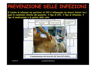 17/01/17 Lupattelli Marilena
PREVENZIONE DELLE INFEZIONI
Il rischio di infezioni nei portatori di CVC è influenzato da diversi fattori tra i
quali le condizioni cliniche del paziente, il tipo di CVC, il tipo di infusione, il
tipo di medicazione e la pulizia della cute.
 