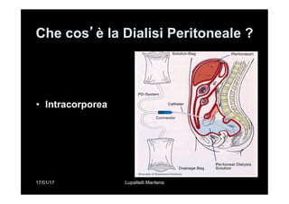 17/01/17 Lupattelli Marilena
Che cos’è la Dialisi Peritoneale ?
•  Intracorporea
 