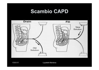 17/01/17 Lupattelli Marilena
Scambio CAPD
 