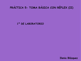 PRÁCTICA 5- TOMA BÁSICA CON RÉFLEX (II)

1º DE LABORATORIO

Ilenia Blázquez

 