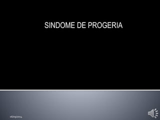 SINDOME DE PROGERIA 
06/09/2014 
 