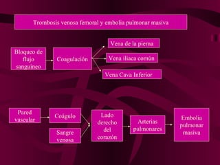 Trombosis venosa femoral y embolia pulmonar masiva Bloqueo de flujo sanguíneo Coagulación Vena de la pierna Vena iliaca común Vena Cava Inferior Pared vascular Coágulo Sangre venosa Lado derecho del corazón Arterias pulmonares Embolia pulmonar masiva 