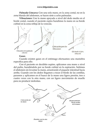 www.felipeisidro.com
Palmada Cóncava: Con una sola mano, en la zona costal, no en la
zona blanda del abdomen, se hacen siete u ocho palmadas.
Vibraciones: Con la mano apoyada a nivel del dedo medio en el
borde costal, cuando el paciente espira hundimos la mano en su borde
cubital en la zona refleja de la vesícula.
Gases
Cuando existen gases en el estómago efectuamos una maniobra
específica para ello.
Con el paciente en decúbito supino, aplicamos una mano a nivel
del pubis, hundiéndola por su borde cubital en la espiración. Subimos
el abdomen sin levantar la mano, arrastrando el paquete intestinal hacia
arriba. Cuando con los dedos llegamos a tocar el borde de las costillas,
paramos y aplicamos en el hueco de la mano una ligera presión, tres o
cuatro veces con la otra mano, con un ligero movimiento de muelle
para no producir molestias.
 