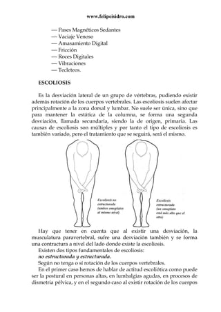 www.felipeisidro.com
 Pases Magnéticos Sedantes
 Vaciaje Venoso
 Amasamiento Digital
 Fricción
 Roces Digitales
 Vibraciones
 Tecleteos.
ESCOLIOSIS
Es la desviación lateral de un grupo de vértebras, pudiendo existir
además rotación de los cuerpos vertebrales. Las escoliosis suelen afectar
principalmente a la zona dorsal y lumbar. No suele ser única, sino que
para mantener la estática de la columna, se forma una segunda
desviación, llamada secundaria, siendo la de origen, primaria. Las
causas de escoliosis son múltiples y por tanto el tipo de escoliosis es
también variado, pero el tratamiento que se seguirá, será el mismo.
Hay que tener en cuenta que al existir una desviación, la
musculatura paravertebral, sufre una desviación también y se forma
una contractura a nivel del lado donde existe la escoliosis.
Existen dos tipos fundamentales de escoliosis:
no estructurada y estructurada.
Según no tenga o sí rotación de los cuerpos vertebrales.
En el primer caso hemos de hablar de actitud escoliótica como puede
ser la postural en personas altas, en lumbalgias agudas, en procesos de
dismetria pélvica, y en el segundo caso al existir rotación de los cuerpos
 