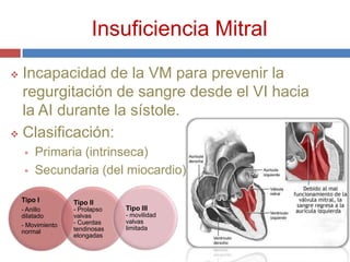 Insuficiencia Mitral
 Incapacidad de la VM para prevenir la
  regurgitación de sangre desde el VI hacia
  la AI durante la sístole.
 Clasificación:

       Primaria (intrinseca)
       Secundaria (del miocardio)

    Tipo I         Tipo II
    - Anillo       - Prolapso   Tipo III
    dilatado       valvas       - movilidad
                   - Cuerdas    valvas
    - Movimiento                limitada
    normal         tendinosas
                   elongadas
 