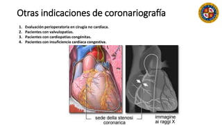 Otras indicaciones de coronariografía
1. Evaluación perioperatoria en cirugía no cardíaca.
2. Pacientes con valvulopatías.
3. Pacientes con cardiopatías congénitas.
4. Pacientes con insuficiencia cardíaca congestiva.
 