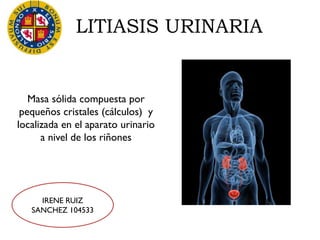 LITIASIS URINARIA
Masa sólida compuesta por
pequeños cristales (cálculos) y
localizada en el aparato urinario
a nivel de los riñones
IRENE RUIZ
SANCHEZ 104533
 