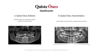 Quiste Óseo
Cl
a
si
f
ic
a
ción
Colón, Ciudad de Colón - Caja de Seguro Social - Dra. Michelle Marie Rohrmoser A.
B. Quiste Óseo Aneurismático
A. Quiste Óseo Solitario
Cavidad intraósea sin recubrimiento epitelial,


considerado un pseudoquiste Lesión benigna que puede afectar a cualquier hueso del cuerpo
 