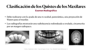 Clasi
fi
cación de los Quistes de los Maxilares
• Debe realizarse con la ayuda de una rx oculsal, panorámica, una proyección de
Waters para el maxilar.


• Las radiogra
f
ías mostrarán una radiolucencia redondeada u ovalada, circunscrita
por un margen radiopaco.
Ex
a
men R
a
diogr
á
f
ico
Colón, Ciudad de Colón - Caja de Seguro Social - Dra. Michelle Marie Rohrmoser A.
 