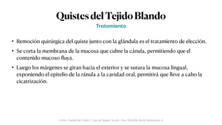QuistesdelTejidoBlando
• Remoción quirúrgica del quiste junto con la glándula es el tratamiento de elección.


• Se corta la membrana de la mucosa que cubre la cánula, permitiendo que el
contenido mucoso
fl
uya.


• Luego los márgenes se giran hacia el exterior y se sutura la mucosa lingual,
exponiendo el epitelio de la ránula a la cavidad oral, permitirá que lleve a cabo la
cicatrización.
Tr
a
t
a
miento
Colón, Ciudad de Colón - Caja de Seguro Social - Dra. Michelle Marie Rohrmoser A.
 