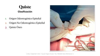 Quiste
Cl
a
si
f
ic
a
ción
1. Origen Odontogénico Epitelial


2. Origen No Odontogénico Epitelial


3. Quiste Óseo
Colón, Ciudad de Colón - Caja de Seguro Social - Dra. Michelle Marie Rohrmoser A.
 