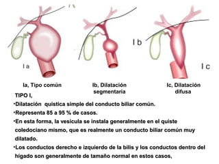Ic, Dilatación
difusa
Ia, Tipo común Ib, Dilatación
segmentaria
TIPO I,TIPO I,
•Dilatación quística simple del conducto biliar común.Dilatación quística simple del conducto biliar común.
•Representa 85 a 95 % de casos.Representa 85 a 95 % de casos.
•En esta forma, la vesícula se instala generalmente en el quisteEn esta forma, la vesícula se instala generalmente en el quiste
coledociano mismo, que es realmente un conducto biliar común muycoledociano mismo, que es realmente un conducto biliar común muy
dilatado.dilatado.
•Los conductos derecho e izquierdo de la bilis y los conductos dentro delLos conductos derecho e izquierdo de la bilis y los conductos dentro del
hígado son generalmente de tamaño normal en estos casos,hígado son generalmente de tamaño normal en estos casos,
 