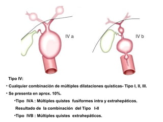 Tipo IV:
• Cualquier combinación de múltiples dilataciones quísticas- Tipo I, II, III.
• Se presenta en aprox. 10%.
•Tipo IVA : Múltiples quistes fusiformes intra y extrahepáticos.
Resultado de la combinación del Tipo I-II
•Tipo IVB : Múltiples quistes extrahepáticos.
 