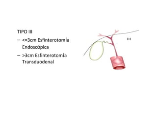 TIPO III
– <=3cm Esfinterotomía
Endoscópica
– >3cm Esfinterotomía
Transduodenal
 