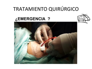 TRATAMIENTO QUIRÚRGICO
¿EMERGENCIA ?
 