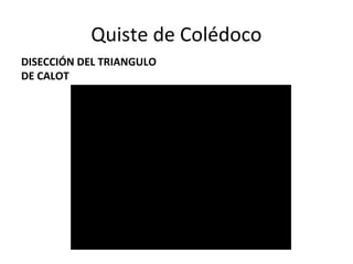 Quiste de Colédoco
DISECCIÓN DEL TRIANGULO
DE CALOT
 