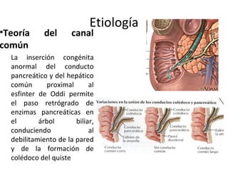 Etiología
•Teoría del canal
común
La inserción congénita
anormal del conducto
pancreático y del hepático
común proximal al
esfinter de Oddi permite
el paso retrógrado de
enzimas pancreáticas en
el árbol biliar,
conduciendo al
debilitamiento de la pared
y de la formación de
colédoco del quiste
 