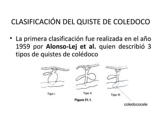 CLASIFICACIÓN DEL QUISTE DE COLEDOCO
• La primera clasificación fue realizada en el año
1959 por Alonso-Lej et al. quien describió 3
tipos de quistes de colédoco
coledococele
 