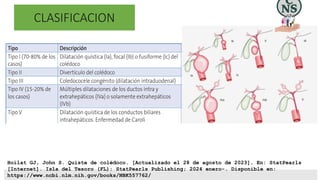 Quiste de Coledoco a proposito de un caso clinico | PPTX