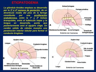 La glándula tiroides empieza su desarrollo por la  3ª ó 4ª semana de gestación , de un divertículo medio del piso de la faringe constituido por una  proliferación endodérmica , entre la 1ª y 2ª bolsas branquiales, entre el tubérculo impar y la lengua en desarrollo, punto que posteriormente será el agujero ciego. Un cordón sólido de células muestra una penetración interior tubular para formar el conducto tirogloso. ETIOPATOGENIA Embrión de 4 semanas Embrión de 5 semanas Embrión de 6 semanas 