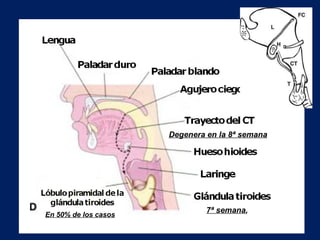 7ª semana ,  Degenera en la 8ª semana En 50% de los casos 
