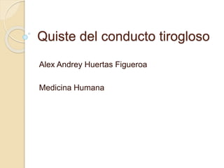 Quiste del conducto tirogloso
Alex Andrey Huertas Figueroa
Medicina Humana
 