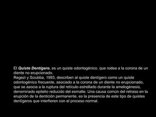 El Quiste Dentígero, es un quiste odontogénico, que rodea a la corona de un 
diente no erupcionado. 
Regezi y Sciubba, 199...