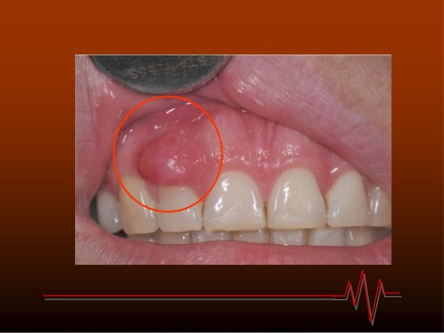dental facts