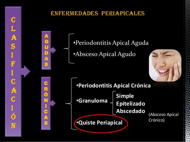 Periodontitis apical cronica pdf