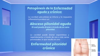 QUISTE PILONIDAL.pptx