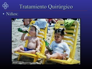 Tratamiento Quirúrgico
• Niños:
 