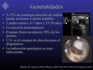 Generalidades
• 5-32% de patología articular de rodilla
  puede asociarse a quiste poplíteo.
• 2 peaks etarios: 4-7 años y 35-70 años.
• La mayoría asintomáticos.
• Examen físico no detecta 50% de los
  quistes.
• U.S. es el examen de elección para el
  diagnóstico.
• La indicación quirúrgica es muy
  infrecuente.



           (Handy JR. Semin Arthritis Rheum. 2001 Oct;31(2):108-18.) Evidencia II-III
 