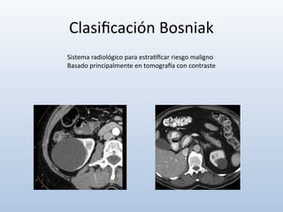 Comprehensive Overview of Renal Cysts: Diagnosis, Classification, and ...