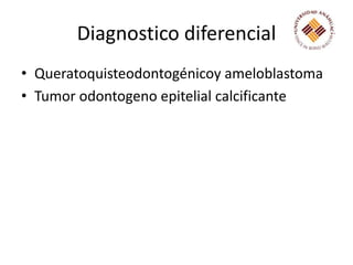 Diagnostico diferencial Queratoquisteodontogénicoy ameloblastomaTumor odontogeno epitelial calcificante