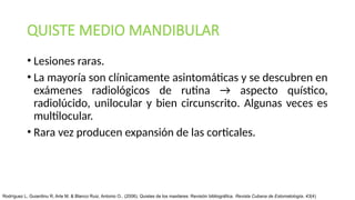 Lesiones Raras Comprehensive Overview of Oral Cysts: Pathophysiology, Diagnosis, and ...