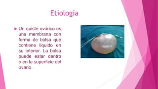 Etiología
 Un quiste ovárico es
una membrana con
forma de bolsa que
contiene liquido en
su interior. La bolsa
puede estar dentro
o en la superficie del
ovario.
 