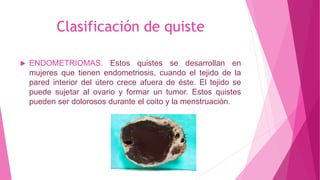 Clasificación de quiste
 ENDOMETRIOMAS. Estos quistes se desarrollan en
mujeres que tienen endometriosis, cuando el tejido de la
pared interior del útero crece afuera de éste. El tejido se
puede sujetar al ovario y formar un tumor. Estos quistes
pueden ser dolorosos durante el coito y la menstruación.
 