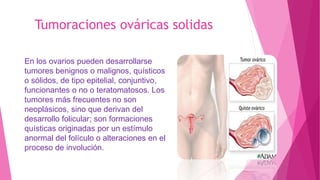 En los ovarios pueden desarrollarse
tumores benignos o malignos, quísticos
o sólidos, de tipo epitelial, conjuntivo,
funcionantes o no o teratomatosos. Los
tumores más frecuentes no son
neoplásicos, sino que derivan del
desarrollo folicular; son formaciones
quísticas originadas por un estímulo
anormal del folículo o alteraciones en el
proceso de involución.
Tumoraciones ováricas solidas
 