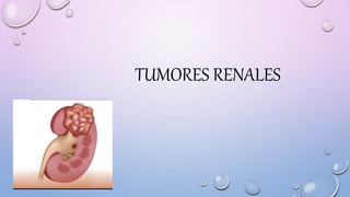 TUMORES RENALES
 