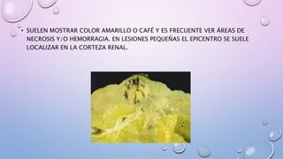 • SUELEN MOSTRAR COLOR AMARILLO O CAFÉ Y ES FRECUENTE VER ÁREAS DE
NECROSIS Y/O HEMORRAGIA. EN LESIONES PEQUEÑAS EL EPICENTRO SE SUELE
LOCALIZAR EN LA CORTEZA RENAL.
 