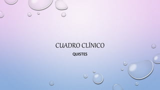 CUADRO CLÍNICO
QUISTES
 