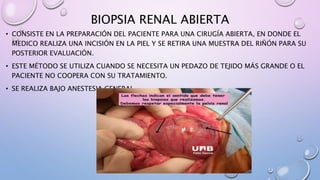 BIOPSIA RENAL ABIERTA
• CONSISTE EN LA PREPARACIÓN DEL PACIENTE PARA UNA CIRUGÍA ABIERTA, EN DONDE EL
MEDICO REALIZA UNA INCISIÓN EN LA PIEL Y SE RETIRA UNA MUESTRA DEL RIÑÓN PARA SU
POSTERIOR EVALUACIÓN.
• ESTE MÉTODO SE UTILIZA CUANDO SE NECESITA UN PEDAZO DE TEJIDO MÁS GRANDE O EL
PACIENTE NO COOPERA CON SU TRATAMIENTO.
• SE REALIZA BAJO ANESTESIA GENERAL.
 