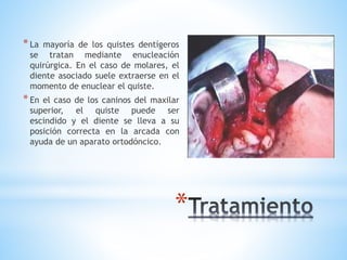 *
*La mayoría de los quistes dentígeros
se tratan mediante enucleación
quirúrgica. En el caso de molares, el
diente asociado suele extraerse en el
momento de enuclear el quiste.
*En el caso de los caninos del maxilar
superior, el quiste puede ser
escindido y el diente se lleva a su
posición correcta en la arcada con
ayuda de un aparato ortodóncico.
 