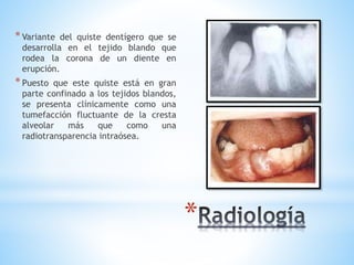 *
*Variante del quiste dentígero que se
desarrolla en el tejido blando que
rodea la corona de un diente en
erupción.
*Puesto que este quiste está en gran
parte confinado a los tejidos blandos,
se presenta clínicamente como una
tumefacción fluctuante de la cresta
alveolar más que como una
radiotransparencia intraósea.
 