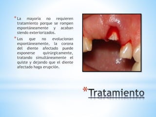 *
*La mayoría no requieren
tratamiento porque se rompen
espontáneamente y acaban
siendo exteriorizados.
*Los que no evolucionan
espontáneamente, la corona
del diente afectado puede
exponerse quirúrgicamente,
tratando simultáneamente el
quiste y dejando que el diente
afectado haga erupción.
 