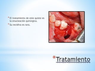 *
*El tratamiento de este quiste es
la enucleación quirúrgica.
*Su recidiva es rara.
 