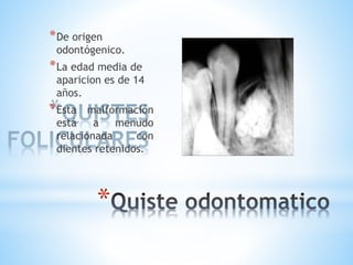 *
*De origen
odontógenico.
*La edad media de
aparicion es de 14
años.
*Esta malformación
está a menudo
relacionada con
dientes retenidos.
 